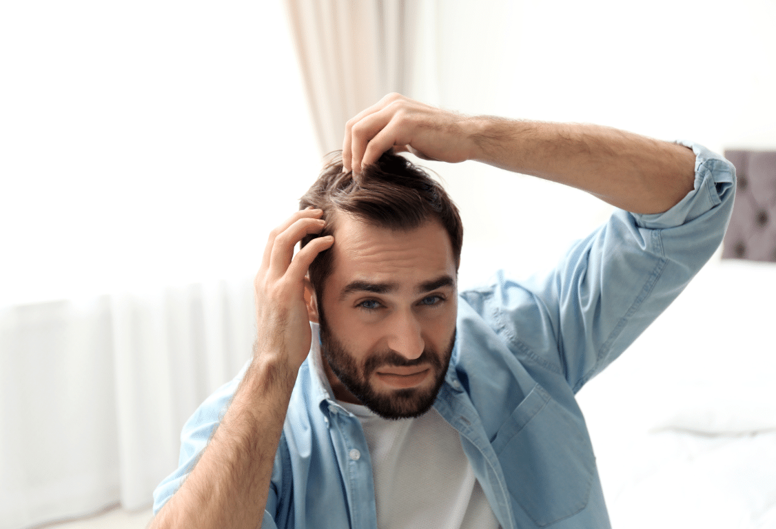 Forskere har fundet en effektiv behandling til hårtab hos mænd: Med dokumenteret effekt